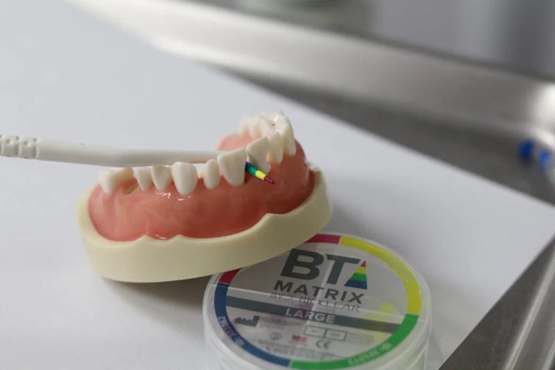 Czarne trójkąty i diastemy: jak je zamknąć metodą Bioclear
