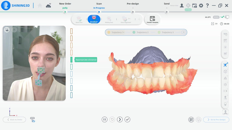 Shining 3D MetiSmile – žandikaulio judesių sekimo modulis