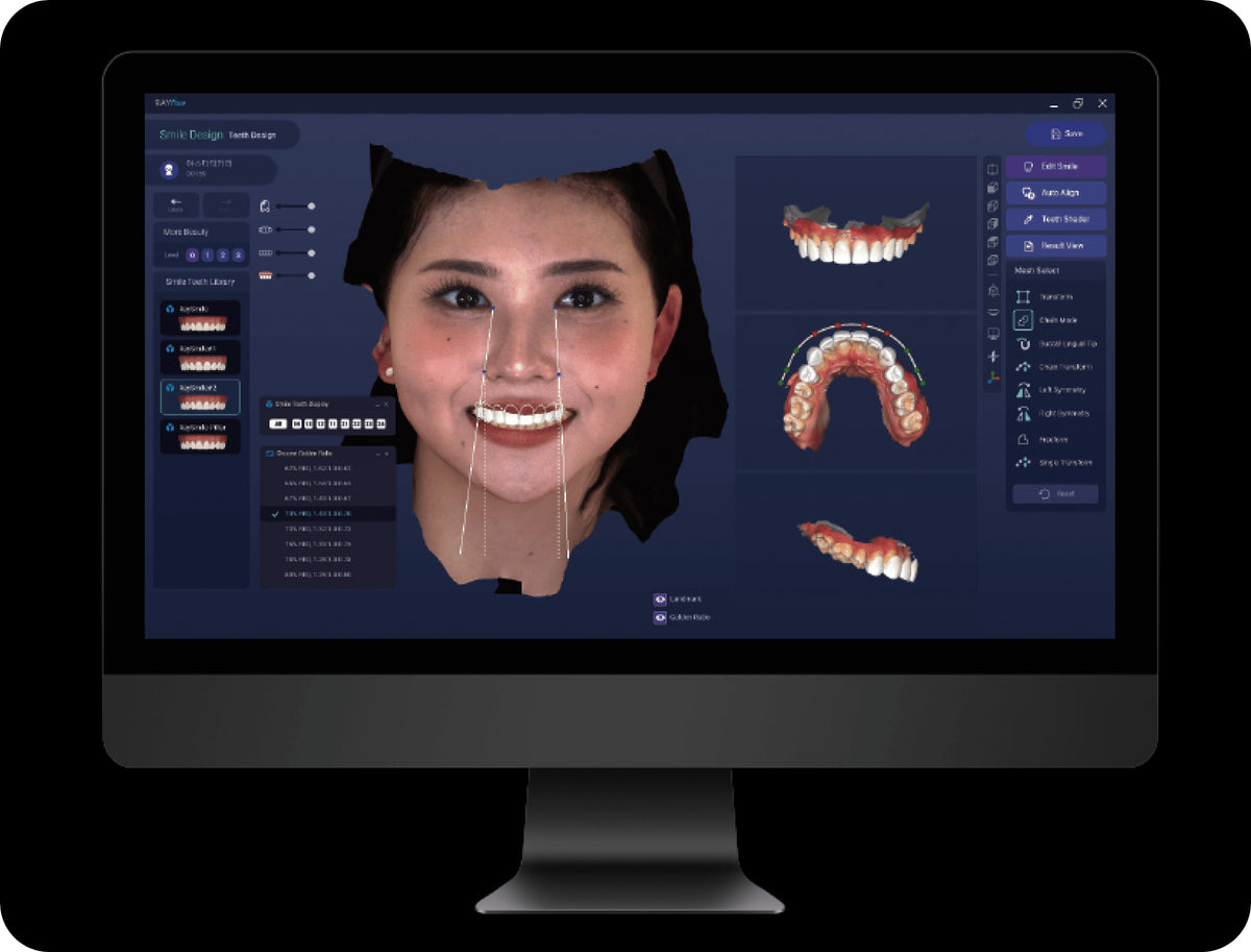 Oprogramowanie RAYFace – model twarzy 3D z danymi ze skanowania zębów