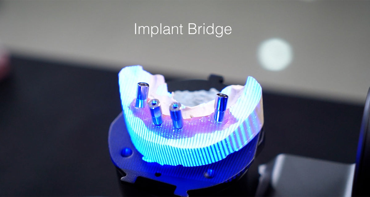 Implantų tilto skenavimas AutoScan-DS-EX Pro(H)